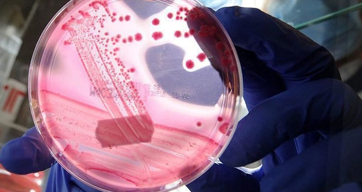 erkeklerde en cok gorulen ikinci kanser turu belli oldu bg6jWiza