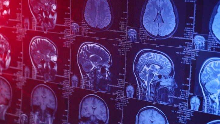 insan beyninin en verimli oldugu yas belli oldu lhap9N5t.jpg